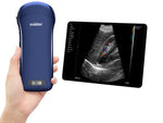 Ecografo Portatile Wireless Lineare Convesso E Cardiaco - Viatom 3in1